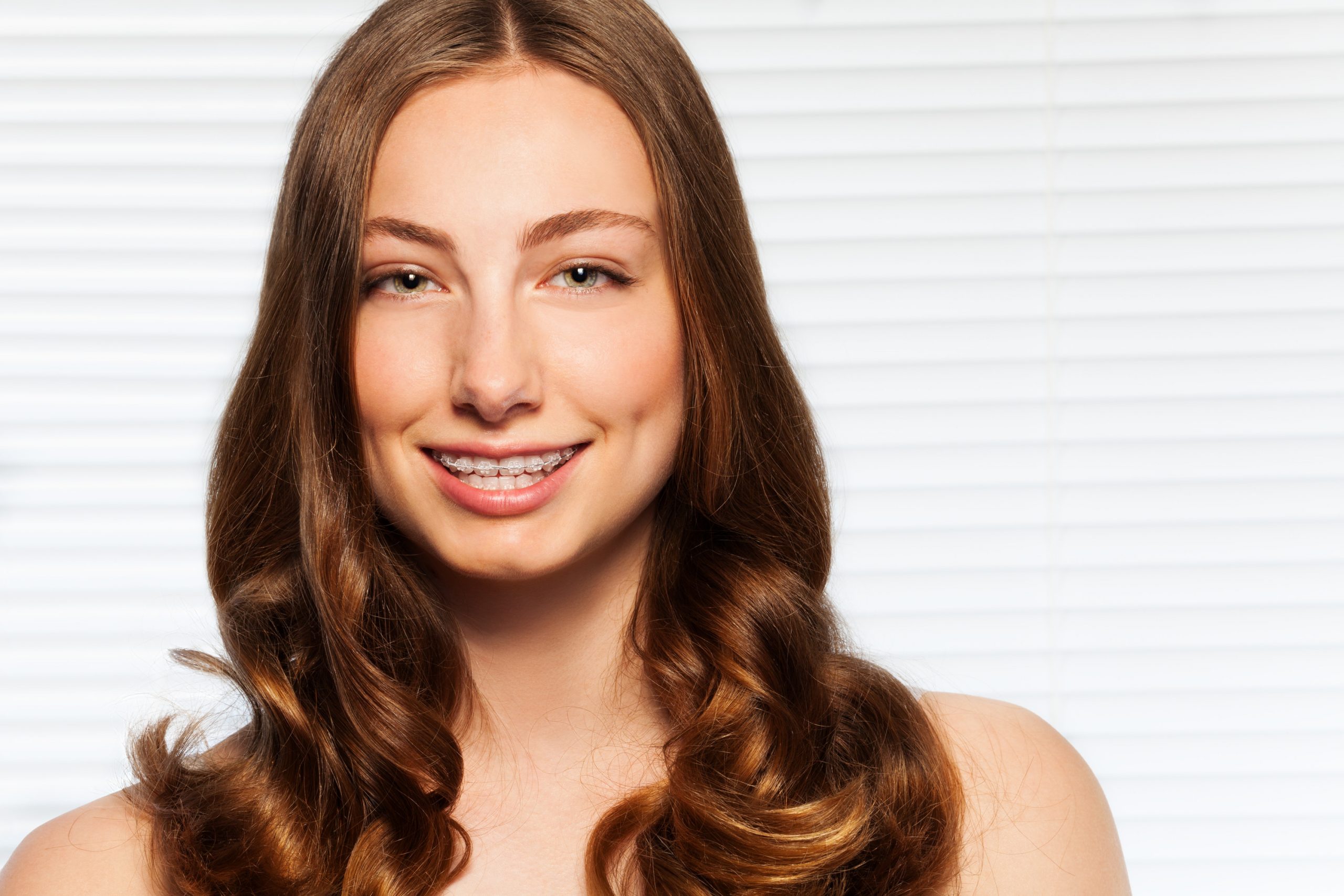 Why Choose Clear Braces in Phoenix?