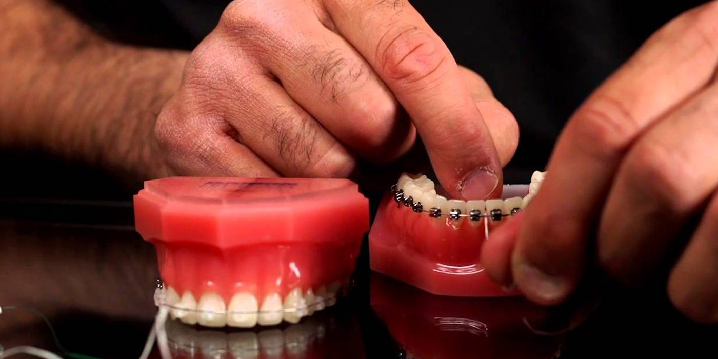 How Do You Floss With Braces?