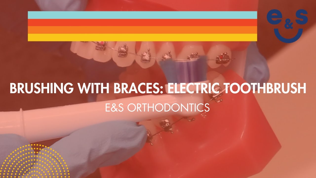 Exceptional Orthodontic Care and Service at E&S Orthodontics